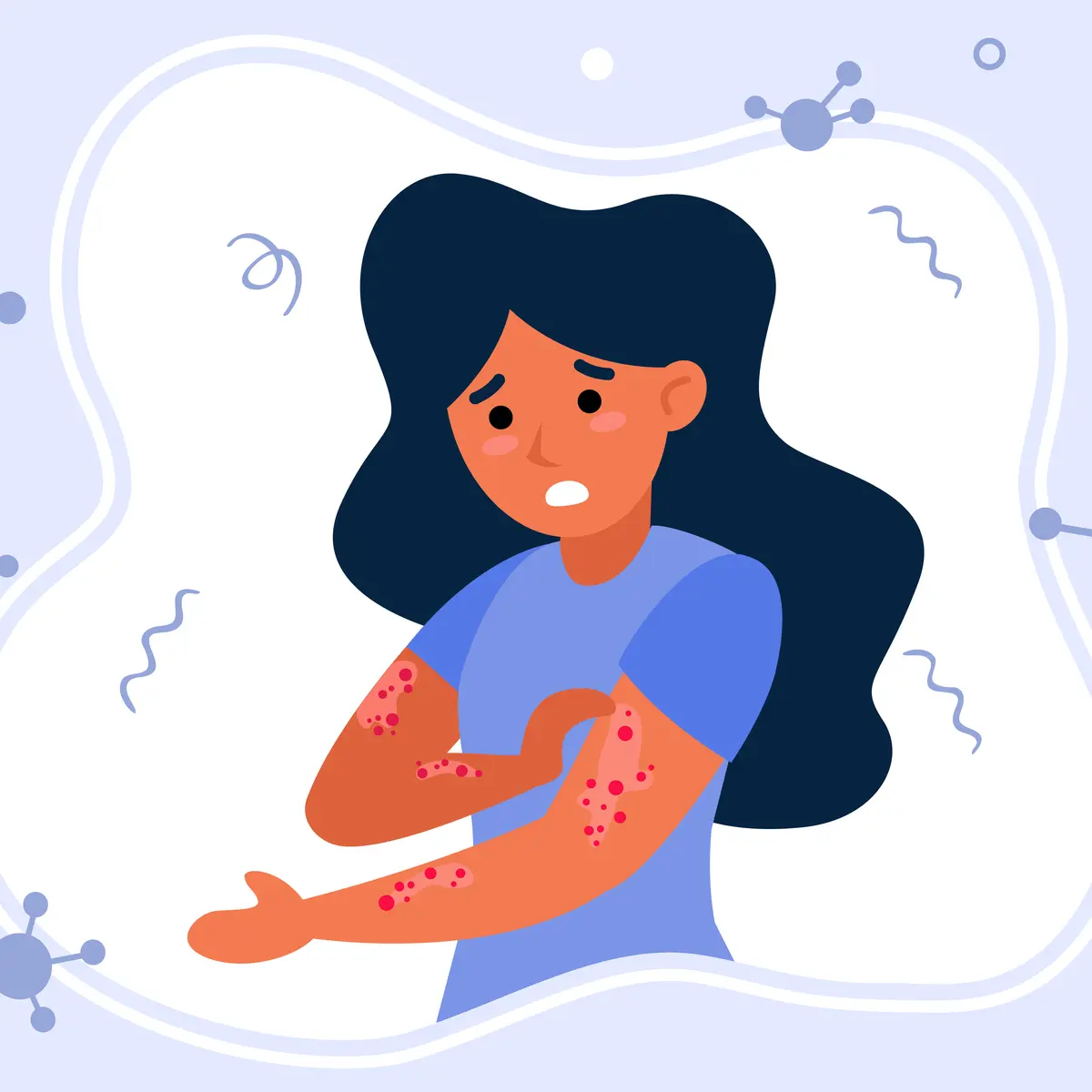 obat sipilis - obat raja singa - obat sifilis - obat sipilis paling ampuh - obat sipilis pada pria - obat herbal sipilis